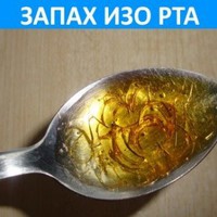 Паховий дерматит у чоловіків і жінок: лікування, симптоми, причини виникнення як лікувати дерматит в паху