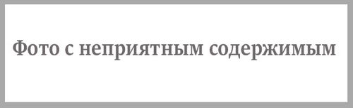 як лікувати дерматит на голові