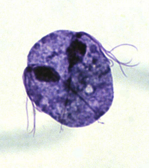 як краще лікувати трихомоніаз