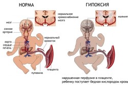 стоп ЗПСШ