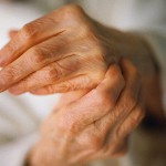 як лікувати суглоби кистей рук