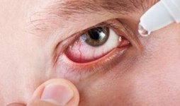 хламідійний кон'юнктивіт Офтальмохламідіоз збудник способи зараження класифікація симптоми діагностика лікування ускладнення очі патологія
