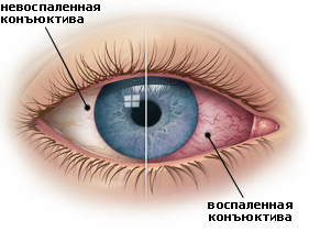 як лікувати алергію на животі