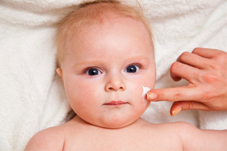 діатез немовля лікування симптоми виглядає причини мазь