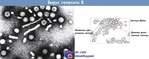 гепатит в при туберкульозі