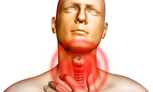 як лікувати тонзиліт горла