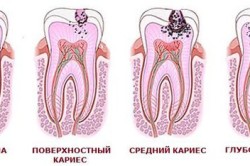 дантист будинку