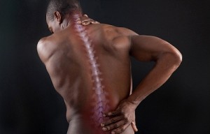 лікувати забій спини