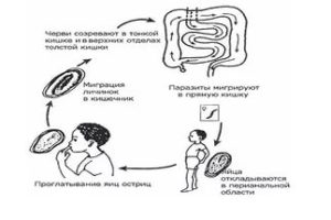 якщо не лікувати гострики що буде