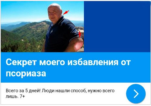 як лікувати псоріаз на ліктях і колінах