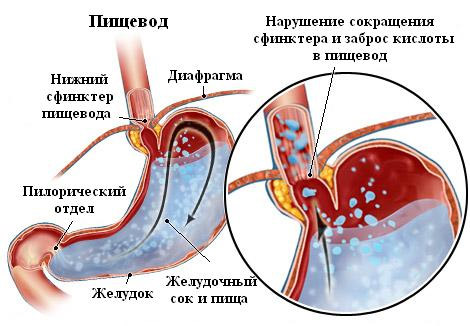 лікування