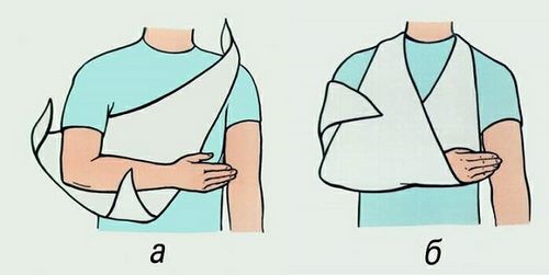 лікувати забій плеча