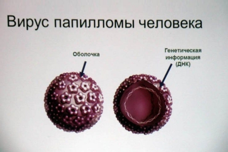 Вірус папіломи у дитини: способи зараження, лікування та профілактика як лікувати папіломи у дитини