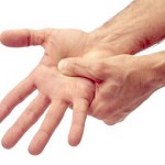 як лікувати розтягнення великого пальця руки
